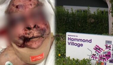 Man charged after elderly dementia patient assaulted at aged care centre in Hammondville, Sydney’s south west