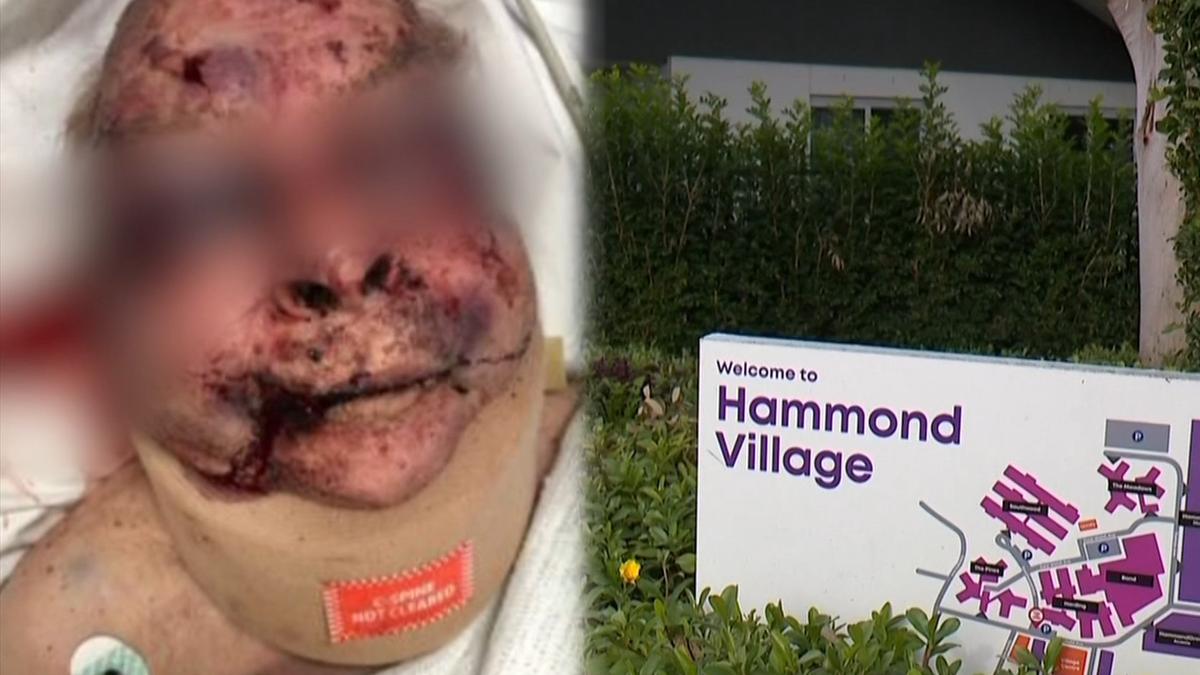 Man charged after elderly dementia patient assaulted at aged care centre in Hammondville, Sydney’s south west