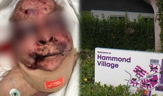 John was attacked an aged care home in Hammondville.