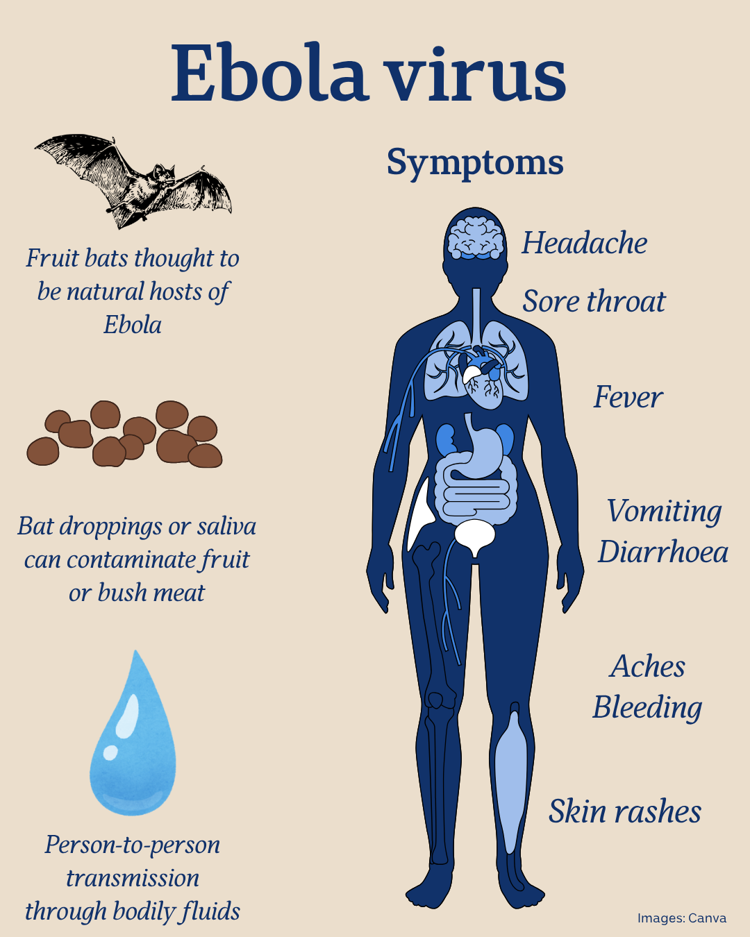 A diagram showing the human body and the symptoms of Ebola