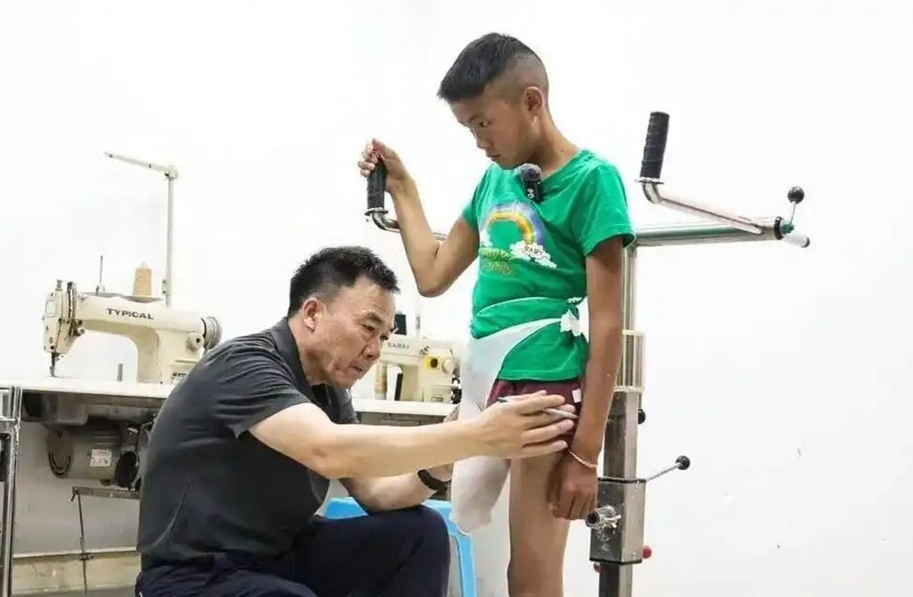 A prosthetic limb expert measures up Apei for his artificial leg. Photo: Handout