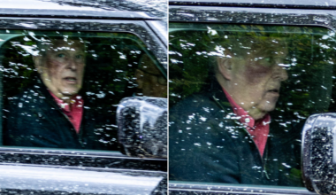 Former prince Andrew spotted with large bruise on his cheek