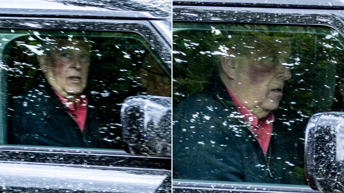 Former prince Andrew spotted with large bruise on his cheek