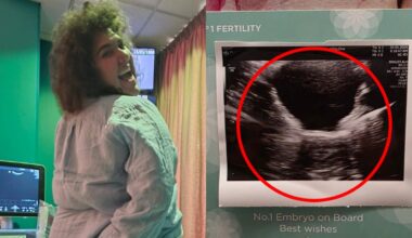 'Now we wait': Casey Donovan reveals major IVF milestone with fiancée Renee Sharples