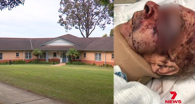 He was left with serious head injuries.