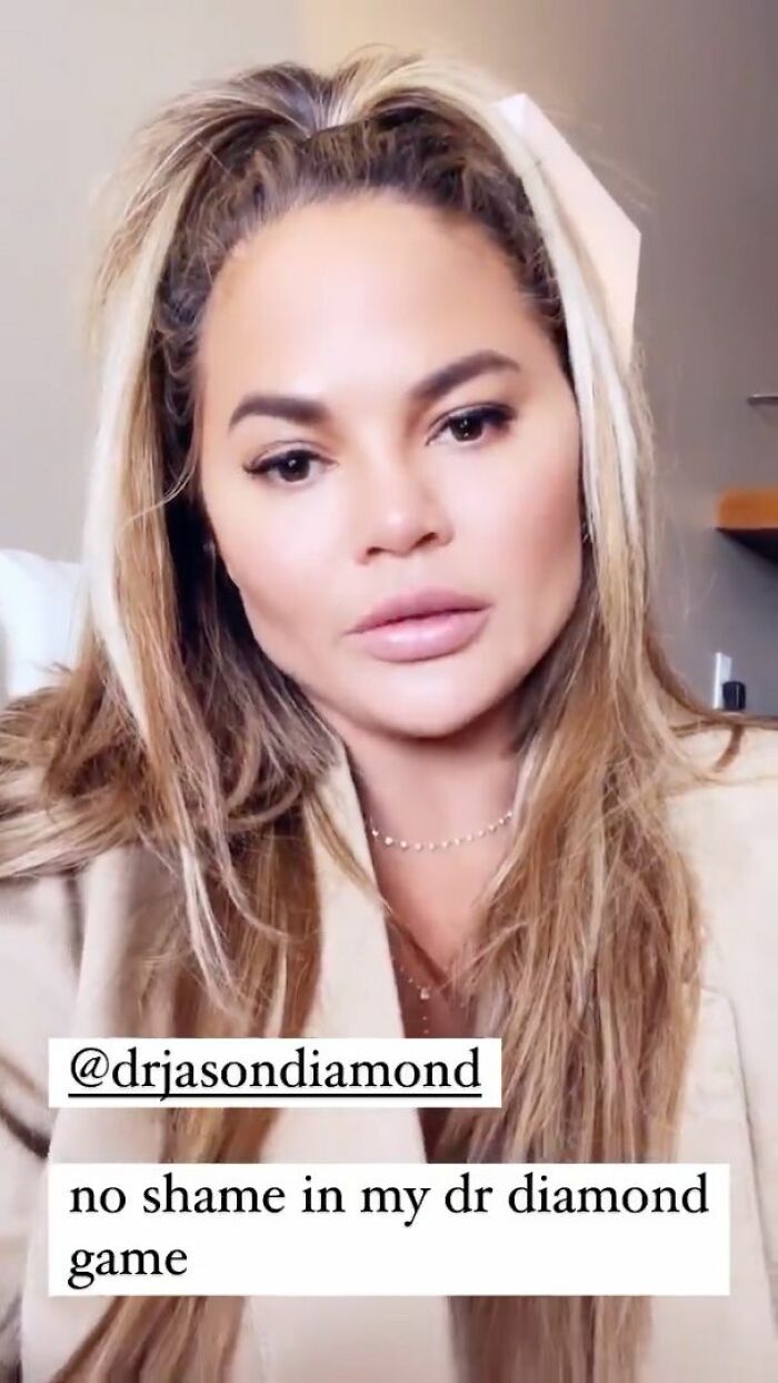 Woman discussing plastic surgery trends and regrets with Dr Diamond Woman discussing plastic surgery trends and regrets with Dr Diamond