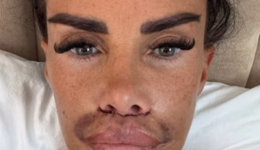 Katie Price shares confronting photo after corrective lip surgery
