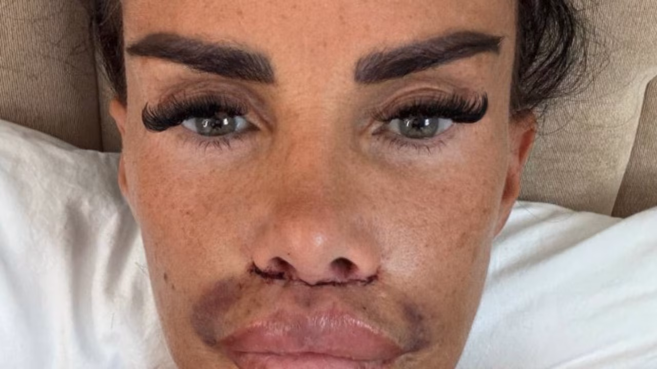 Katie Price shares confronting photo after corrective lip surgery