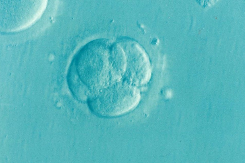 An image of an IVF technique