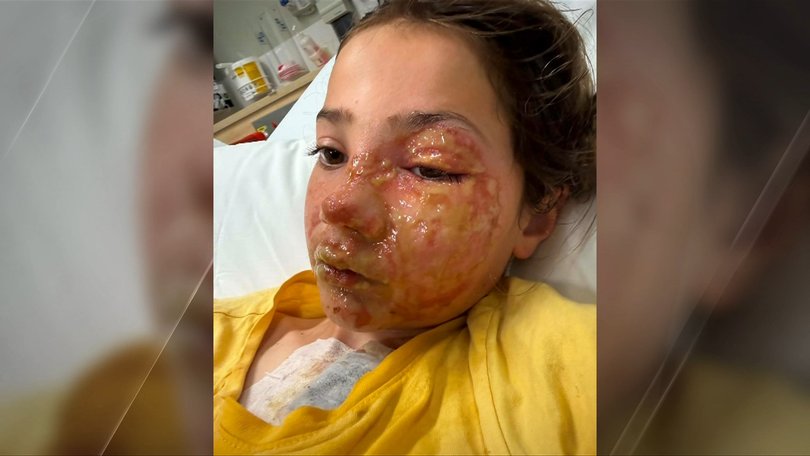 Violet spent a week in hospital recovering. 