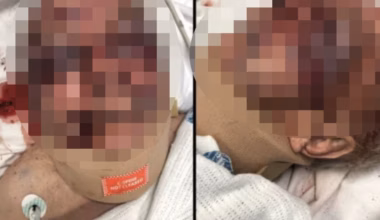 Daughter rejects apology after dad allegedly bashed at Hammondville care home