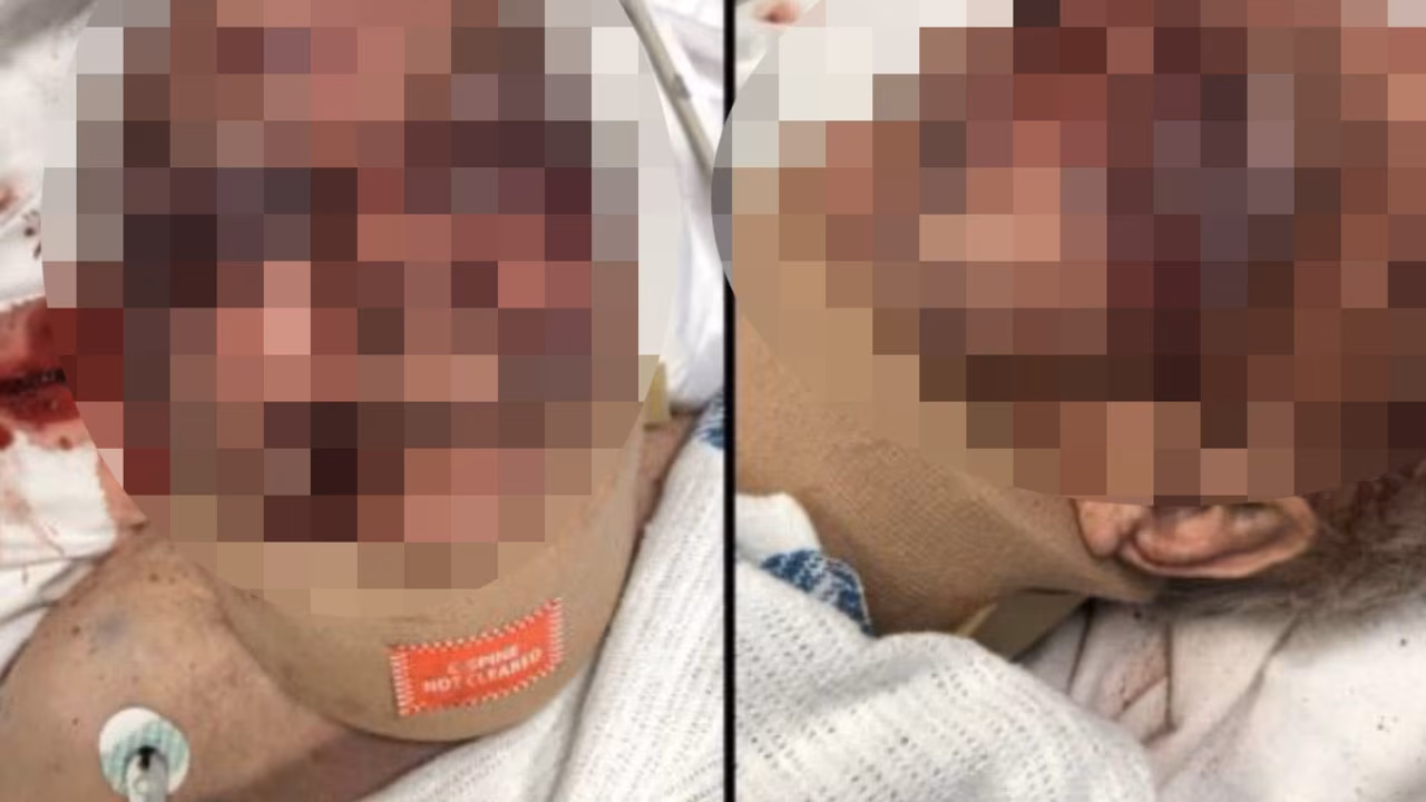 Daughter rejects apology after dad allegedly bashed at Hammondville care home