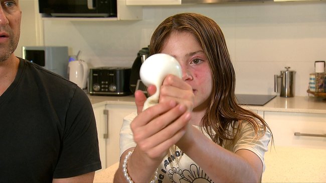 Violet Zerbst demonstrates how a squishy toy exploded in her face.