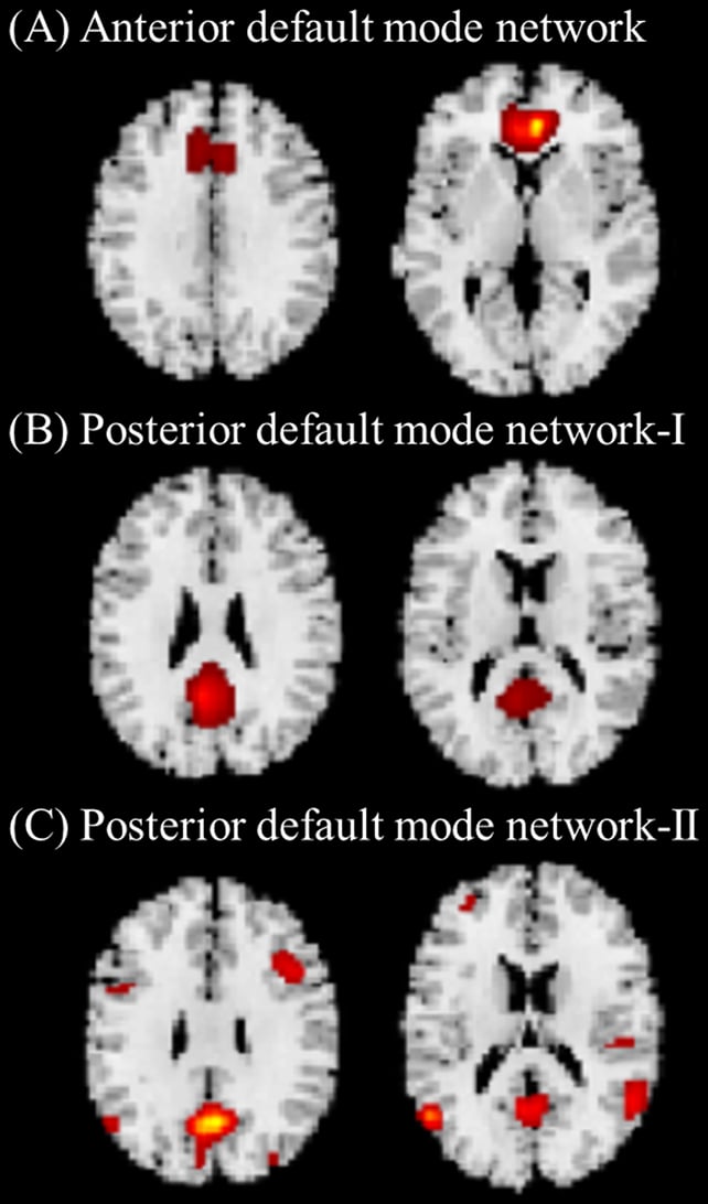 Brain connectivity