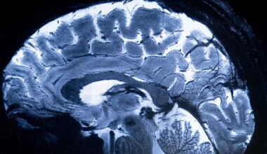 Experimental Brain 'Pacemakers' May Rewire Circuits Linked to Depression : ScienceAlert