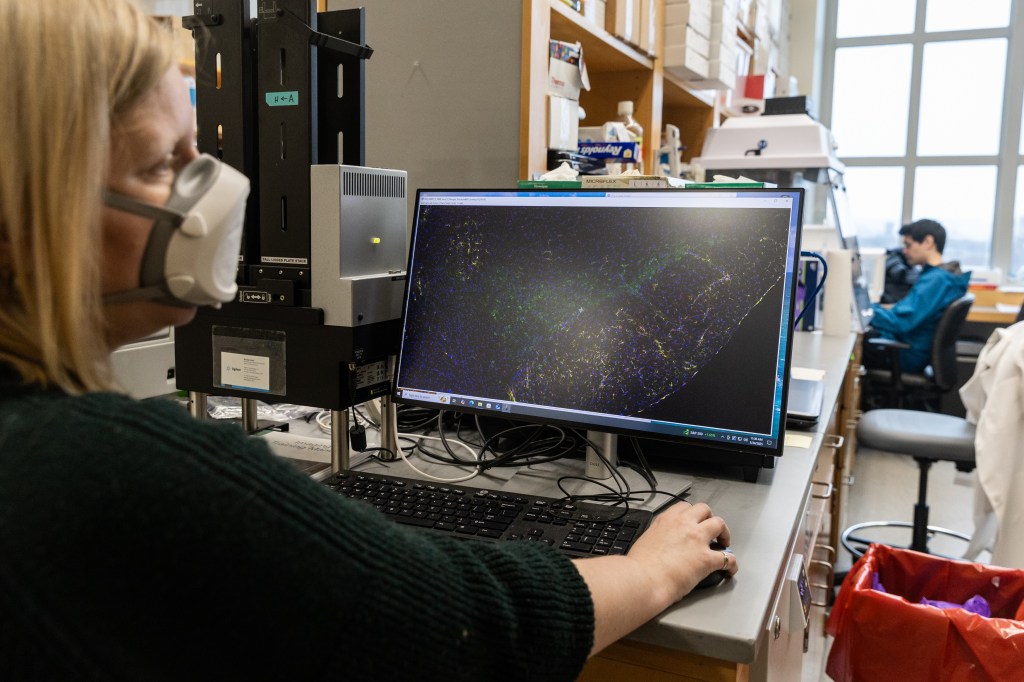 New Haven, CT-March 24: Janna Moen, a Post Doctoral Scientist views imaging of mice brain sections that have been infected and then treated with SARS-CoV-2 and then were fixed and processed and sliced into thin sections for observation at the Iwasaki Lab at Yale School of Medicine in New Haven. CT. Moen is researching the Neurobiology of long COVID. (Photos by Jackie Molloy for The Washington Post via Getty Images)