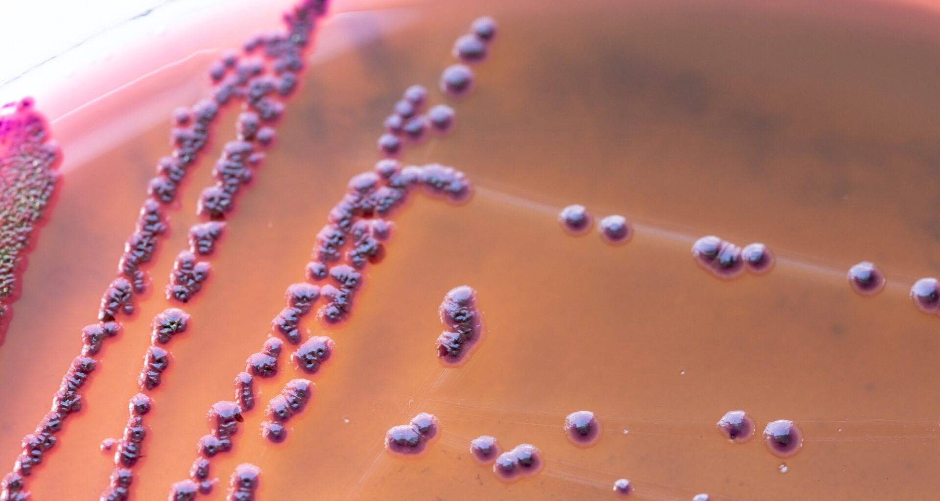 Gut bacteria may help explain why fatigue appears before illness