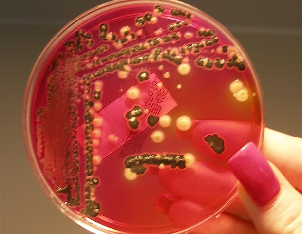 New discovery sheds light on how the human body controls Salmonella infections