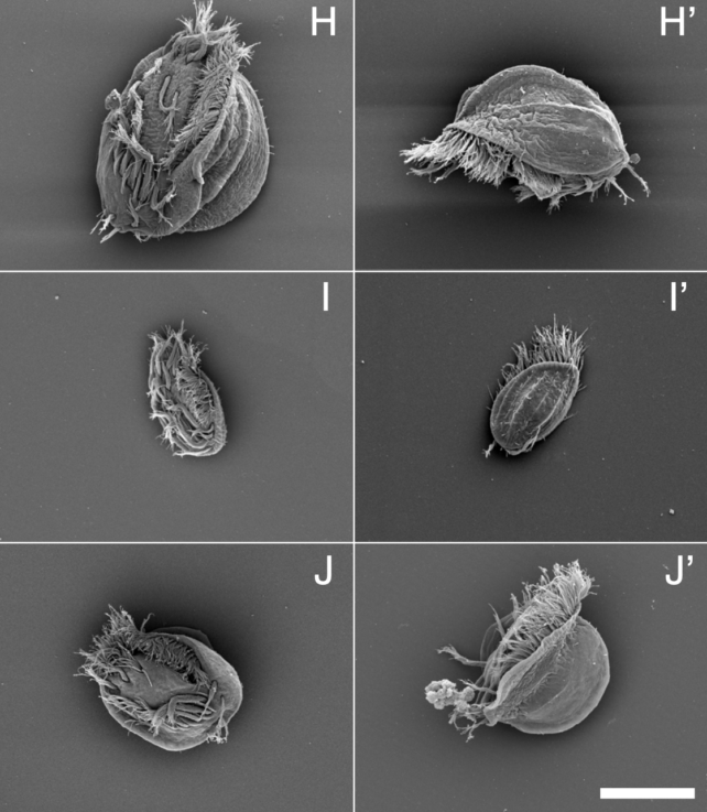Scanning electron microscope images show Euplotes gigatrox cells from several angles. The larger supergiant cells have rounded bodies covered in ridges and hair-like structures, while the smaller normal cells appear more compact and oval-shaped. A scale bar is shown in the lower right.