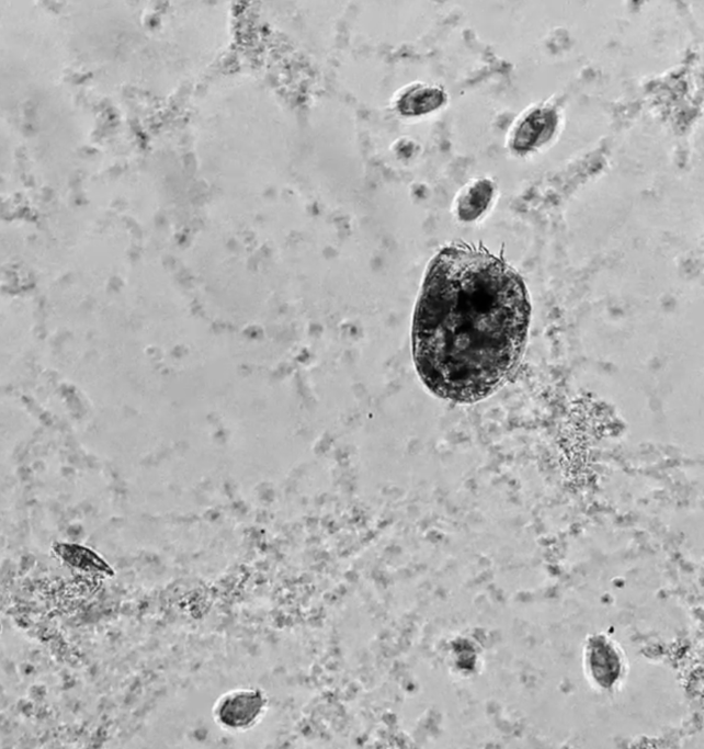 Creepy New Microbe Can Transform Into a Cannibalistic 