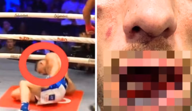 BKFC fighter Connor Tierney retires after suffering horror injury in KO loss to Rico Franco