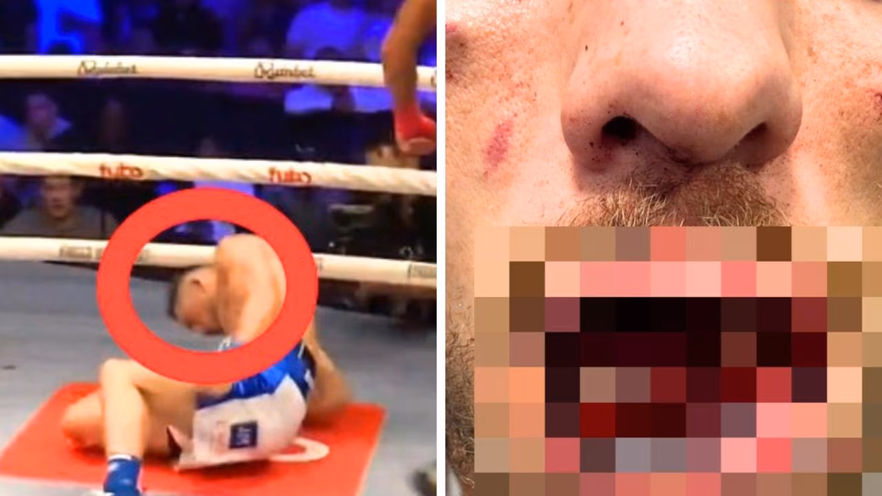 BKFC fighter Connor Tierney retires after suffering horror injury in KO loss to Rico Franco