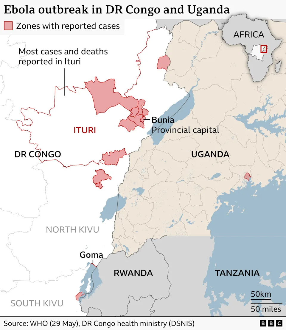 A BBC Map titled “Ebola outbreak in DR Congo and Uganda” showing eastern Democratic Republic of Congo and neighbouring countries Uganda, Rwanda and Tanzania. Areas with reported cases of Ebola are shaded in red, with the largest concentration in the eastern DR Congo province of Ituri. A label notes: “Most cases and deaths reported in Ituri.” Bunia, the provincial capital of Ituri, and near Lake Albert on the Uganda border, is marked as one of the areas with reported cases. Smaller affected zones are also shown in the provinces of North Kivu and South Kivu and one in western Uganda. An outbreak in Goma is labelled in the south of North Kivu on the edge of a lake and near the border with Rwanda. The source for the data on ebola cases is WHO (29 May) and DR Congo health ministry.