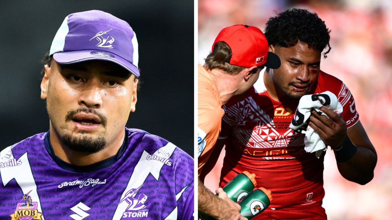 NRL 2026: Melbourne Storm provides updates on Eli Katoa and Tui Kamikamica, injury news, Craig Bellamy, nrl news