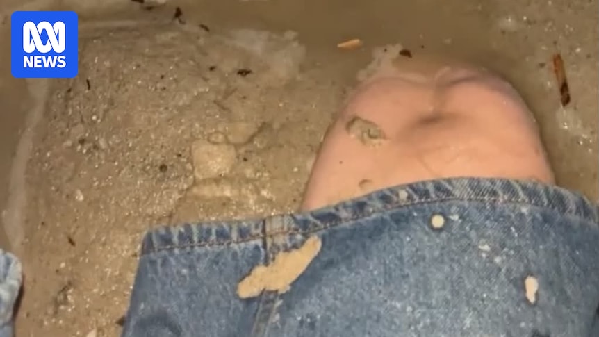 Woman rescued after getting stuck in quicksand at Glenelg North shares warning