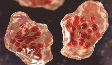 Sydney measles alert issued after infectious person visits multiple locations
