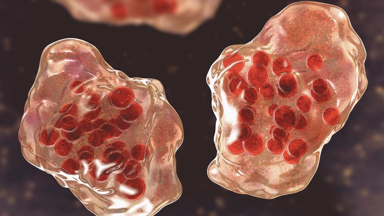 Sydney measles alert issued after infectious person visits multiple locations