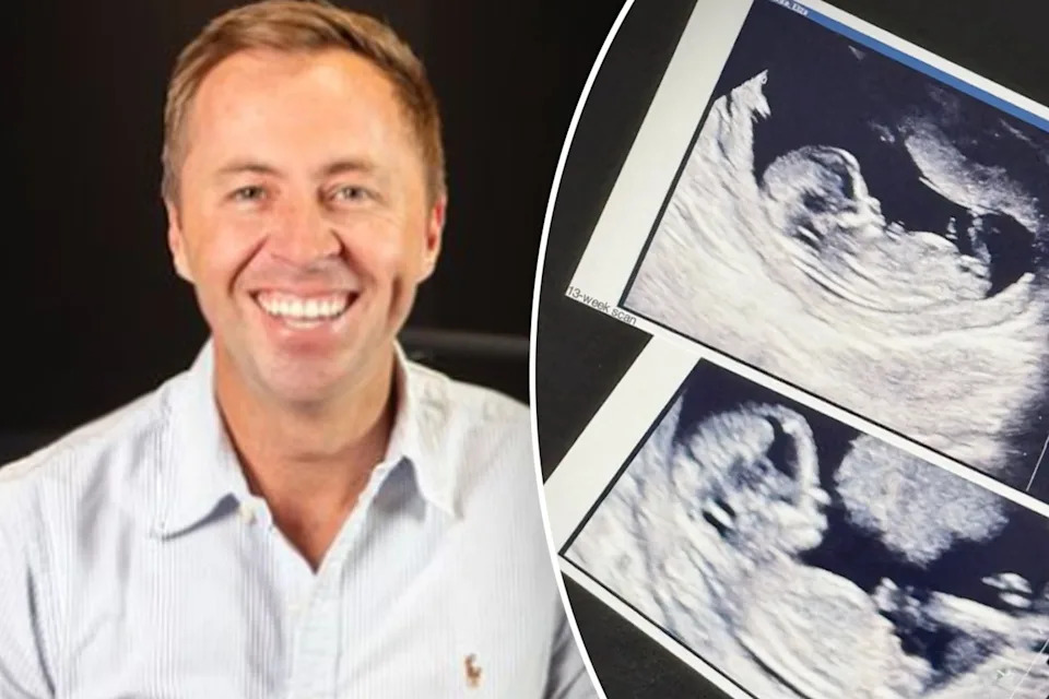 Clint Stanaway has revealed he is going to be a dad for the first time, co-parenting with friend and The Block contestant Eliza Paschke.