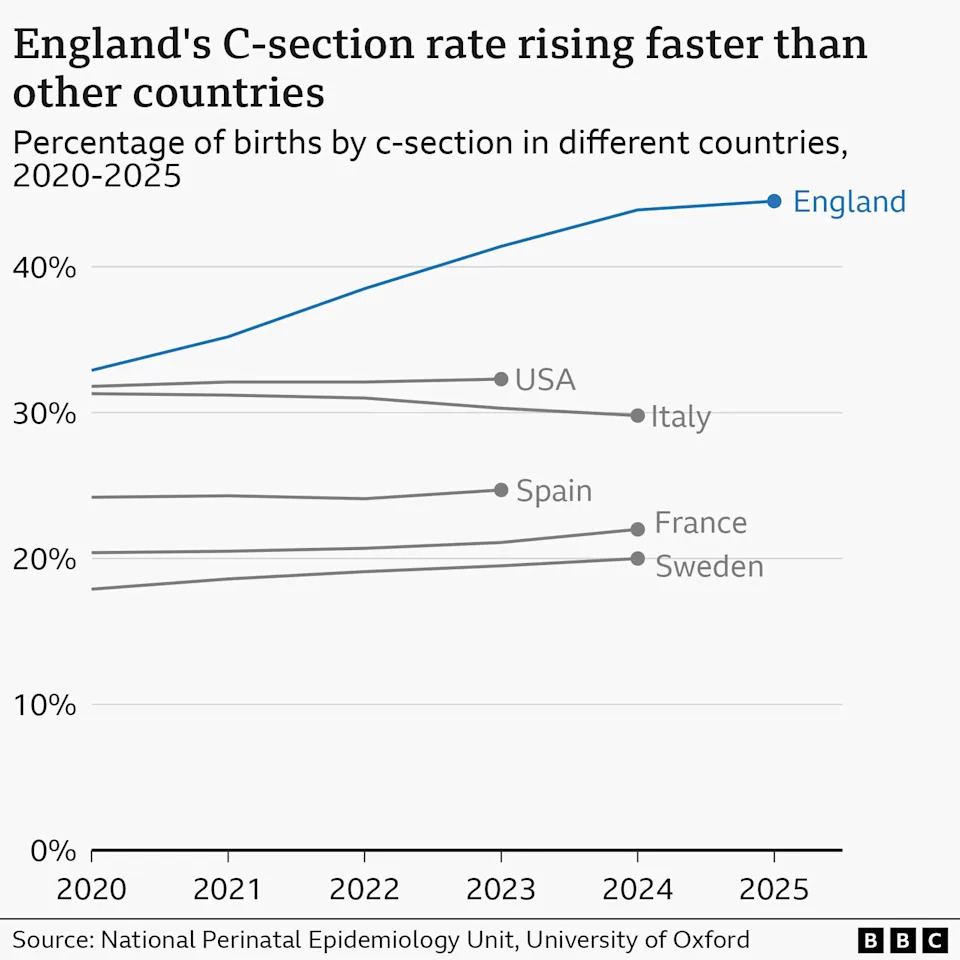 A line graph showing percentage of births by c-section in different countries from 2020-2025 - with England ahead of USA, Italy, Spain, France and Sweden