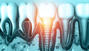 why antibiotics fail against a common dental implant disease