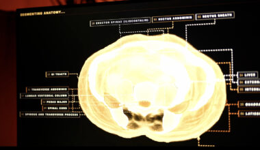 Midjourney, The AI Image Generator, Is Developing A Full-Body Ultrasonic Scanner