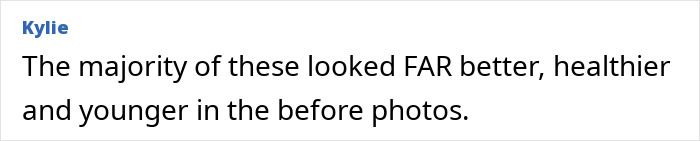 Comment on skeletonized look plastic surgery regrets about healthier before photos Comment on skeletonized look plastic surgery regrets about healthier before photos