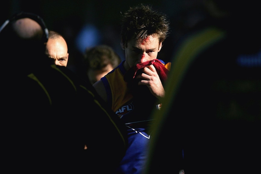 Footballer Adam Hunter with blood on his face.