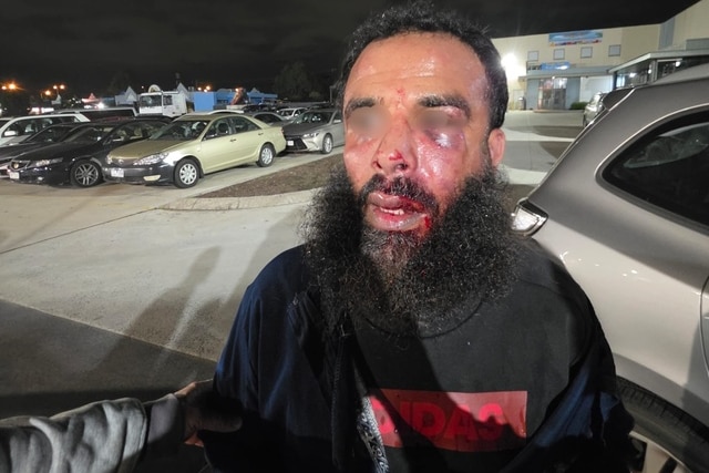 Samir is pictured with eyes and mouth bruised and bloodied.