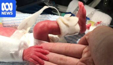 Perth medical researchers working on artificial placentas for premature babies