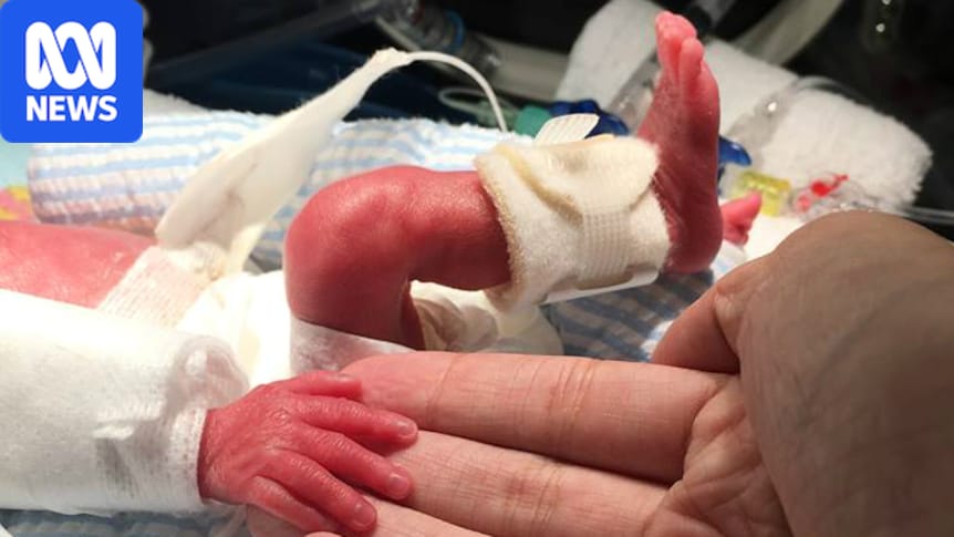 Perth medical researchers working on artificial placentas for premature babies