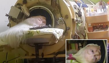 Martha Lillard, last US polio patient using iron lung, dead at 78 in Oklahoma