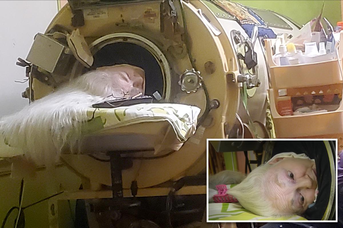 Martha Lillard, last US polio patient using iron lung, dead at 78 in Oklahoma