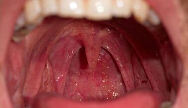 Why Do Humans Have A Uvula? An Evolutionary Biologist Explains
