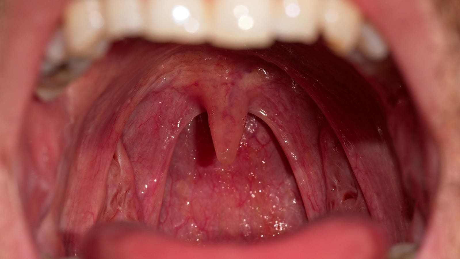 Why Do Humans Have A Uvula? An Evolutionary Biologist Explains