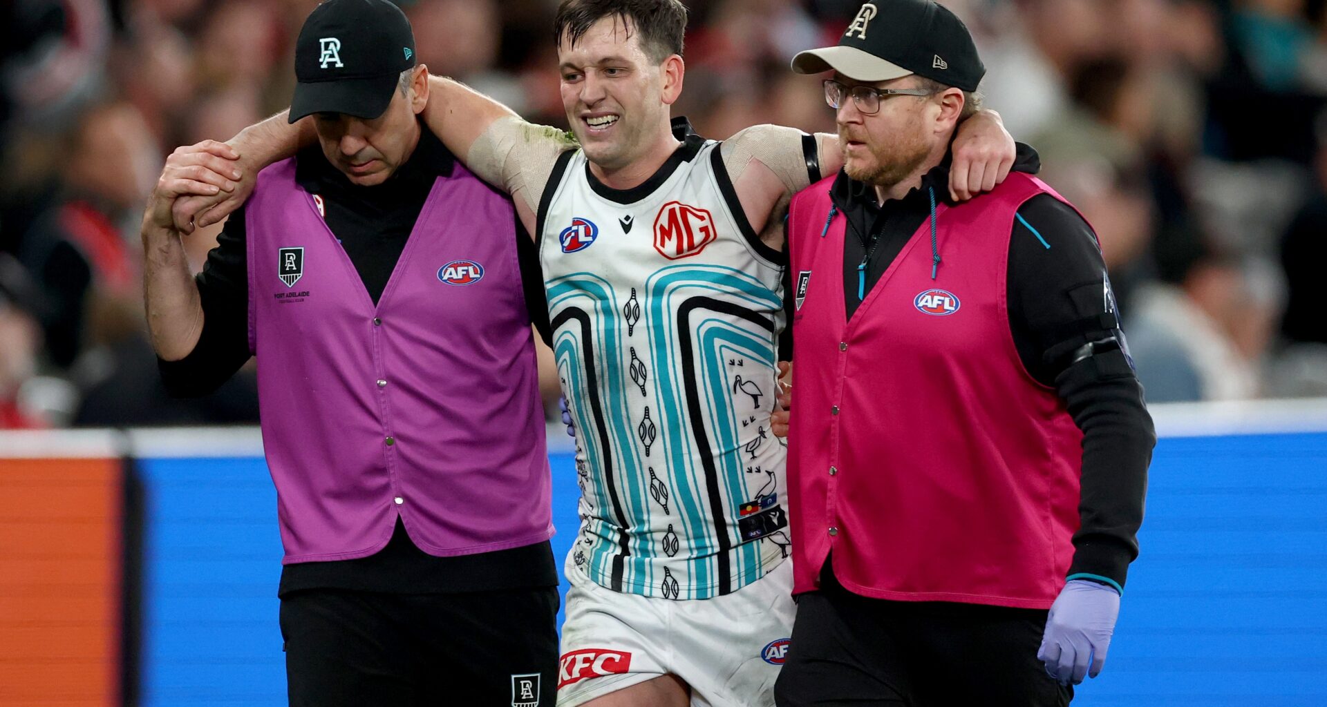 Butters syndesmosis confirmed, Jones cleared of serious injury