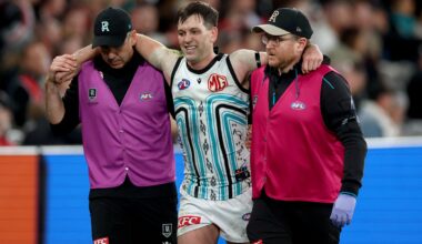 Butters syndesmosis confirmed, Jones cleared of serious injury