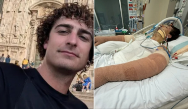 Perth man in hospital with burns to 75 per cent of his body after robot vacuum explodes