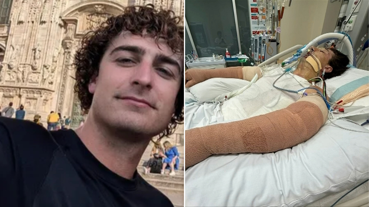 Perth man in hospital with burns to 75 per cent of his body after robot vacuum explodes