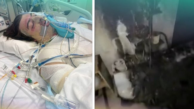 Lachie Perrem was severely injured when a robotic vacuum exploded, leaving the walls blackened.