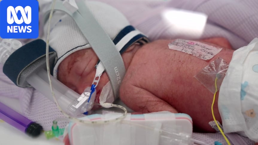 Brisbane woman naturally conceives identical quadruplets in 'one of the rarest births in the world'